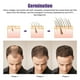 thumbnail image 3 of Uso en el hogar Derma Roller 0.5mm Real Needles Derma Roller Microneedle Roller para el crecimiento del cabello de la barba del cuerpo de la cara Sincero Hogar, 3 of 6
