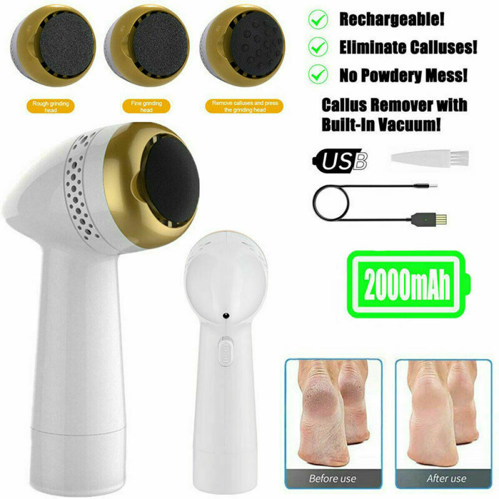 Nifei Electric Foot Callus Remover, Electronic Vacuum Adsorption Foot