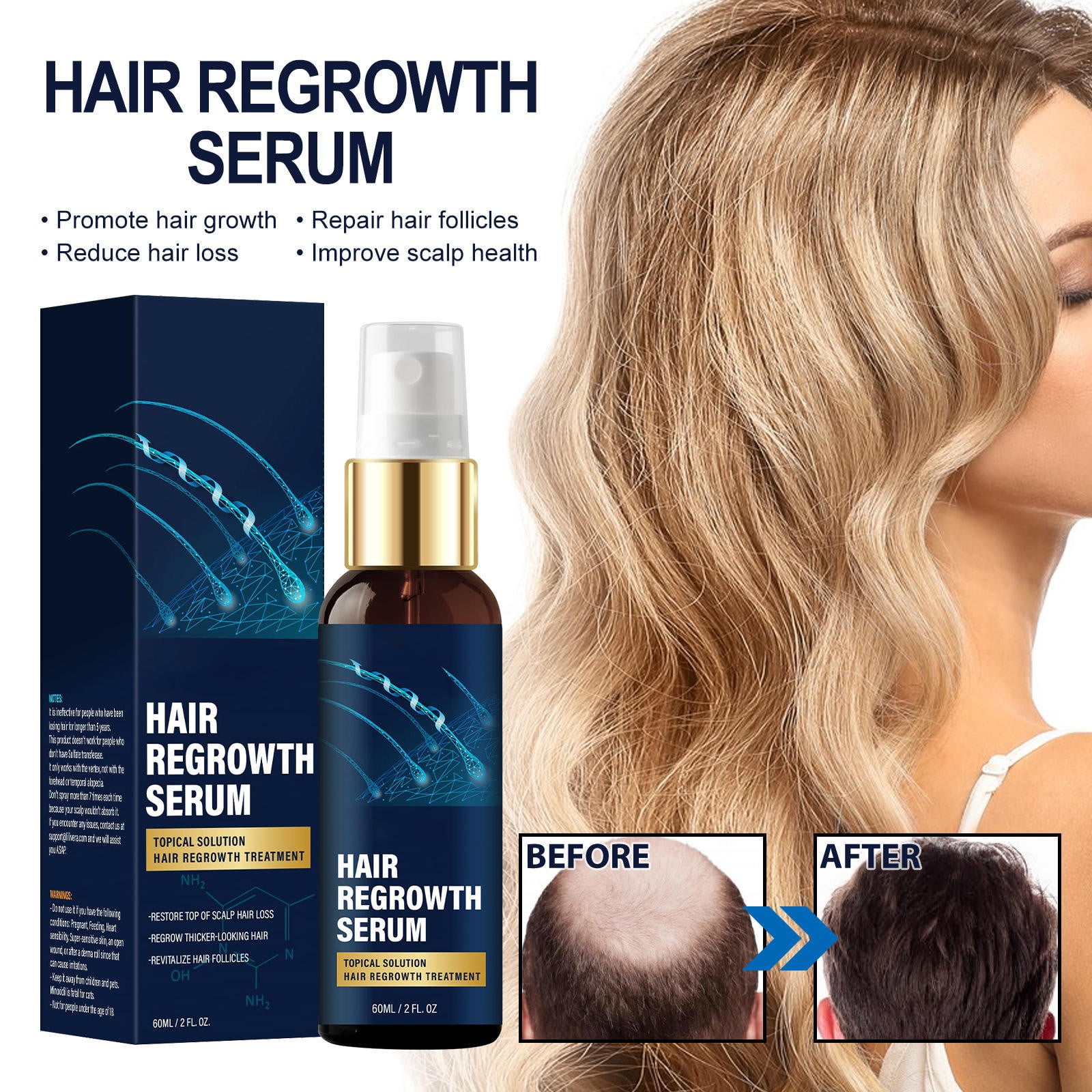 keusn anti fall dense hair essences thick hairline moisturizing dry hair repairs hair root