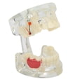thumbnail image 1 of Modelo de enseñanza de estudio de dientes modelo de dientes modelos de dientes dentales modelo de enfermedad periodontal para enseñanza de laboratorio ANGGREK Otros, 1 of 8