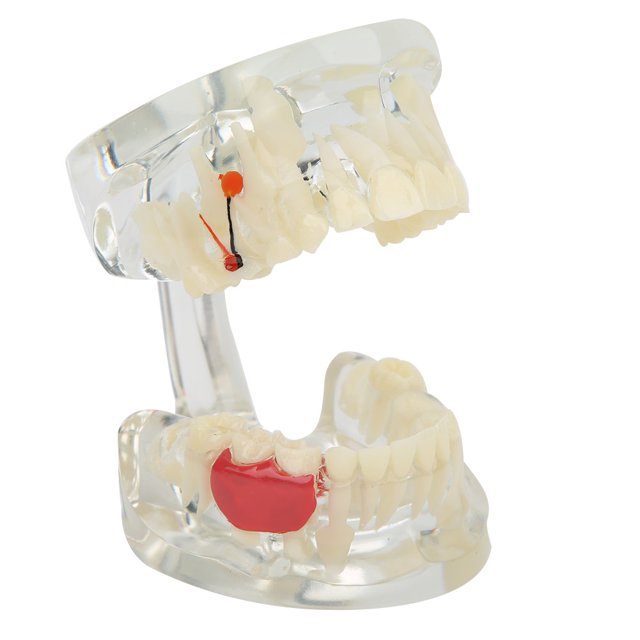 Modelo de enseñanza de estudio de dientes modelo de dientes modelos de dientes dentales modelo de enfermedad periodontal para enseñanza de laboratorio ANGGREK Otros