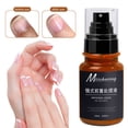 thumbnail image 1 of Fiudx Solución Nutritiva para Uñas, Suaviza y Elimina Rápidamente Las Células Muertas, Hidrata y Mejora La Elasticidad, Cuidado de Uñas Brillantes, Tratamiento Diario para Uñas, Salud de Uñas En Adul, 1 of 6