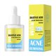 thumbnail image 1 of BUY 2 SAVE 10%!Maojin Suero Salicílico, Salicílico Para El Acné, Suero Facial Hiperpigmentación 30ml, 1 of 9