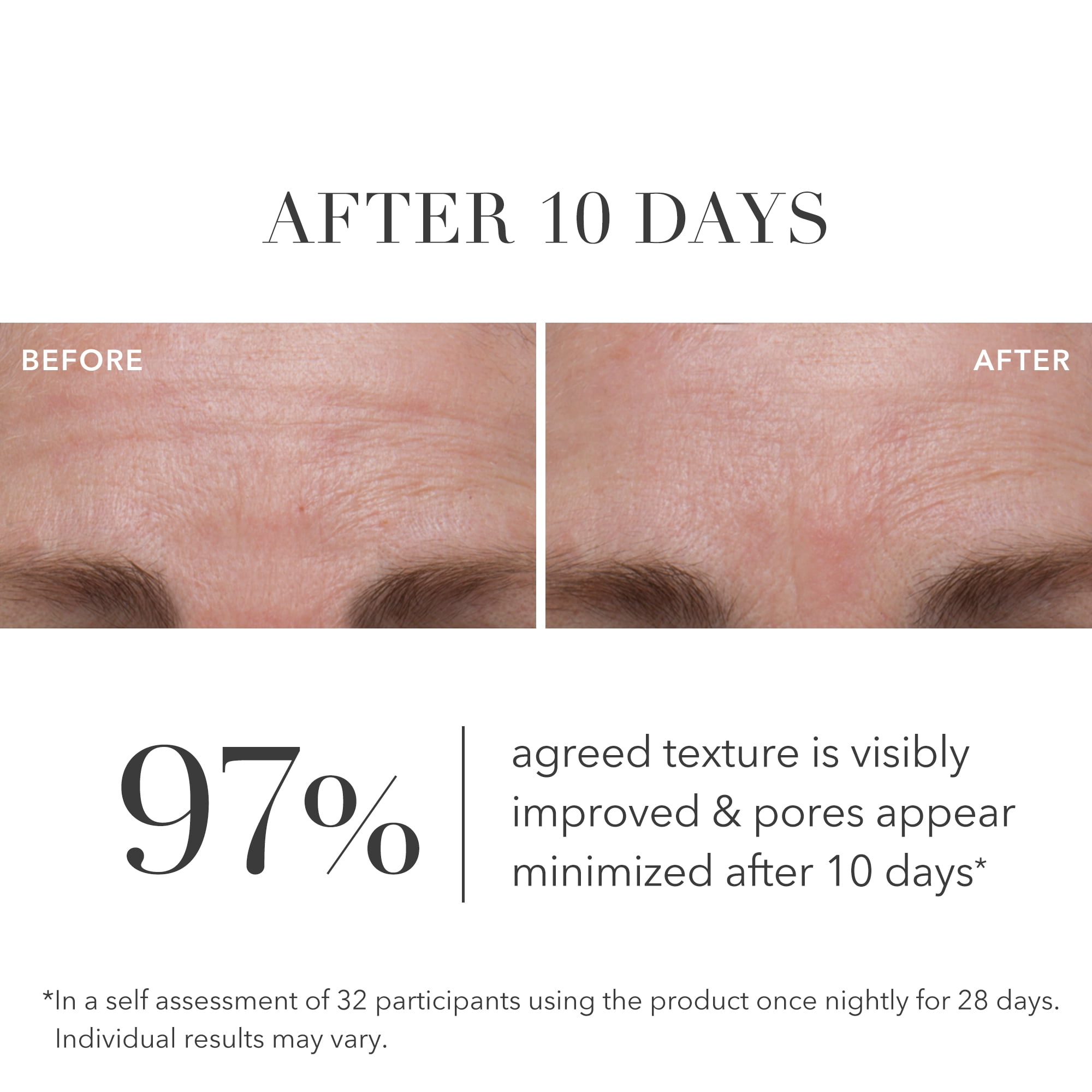 Algenist Green Microalgae Retinol+ Regenerating Serum - Anti Aging Serum with Plant Based, Time-Release Retinol - Evens Texture + Visibly Reduces Deep Lines & Wrinkles with Minimal Irritation (1 oz)