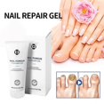 thumbnail image 1 of Healio Nail Treatment Gel ,foot Care Gel Anti Infection Thicken Soft Nails, 1 of 5