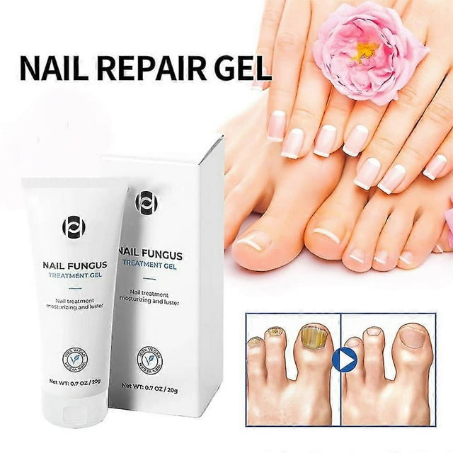 Healio Nail Treatment Gel ,foot Care Gel Anti Infection Thicken Soft Nails