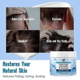 thumbnail image 5 of anti fungal shampoo for scalp treatment, 5 of 5