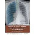 thumbnail image 4 of The Unofficial Guide to Radiology: 100 Practice Chest X Rays with Full Colour Annotations and Full X (Paperback) by Mohammed Rashid Akhtar, Rebecca Best, Lydia Shackshaft, 4 of 4