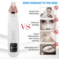 thumbnail image 2 of AMERTEER Blackhead Remover Pore Vacuum - Electric Blackhead Vacuum Cleaner - Blackhead Extractor Removal Suction Beauty Device for Facial Deep Cleansing, 2 of 10