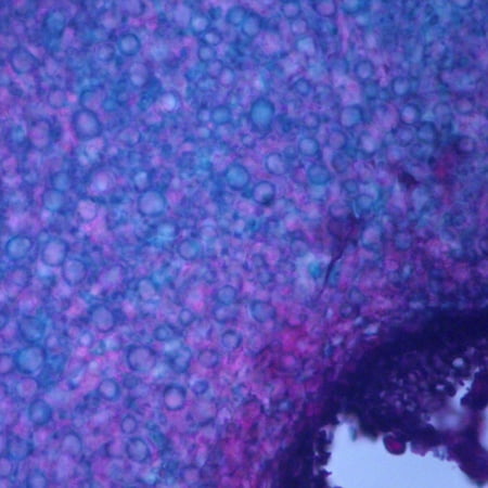 Claviceps Purpurea Mature Sclerotium, C.S., 12 M Microscope Slide