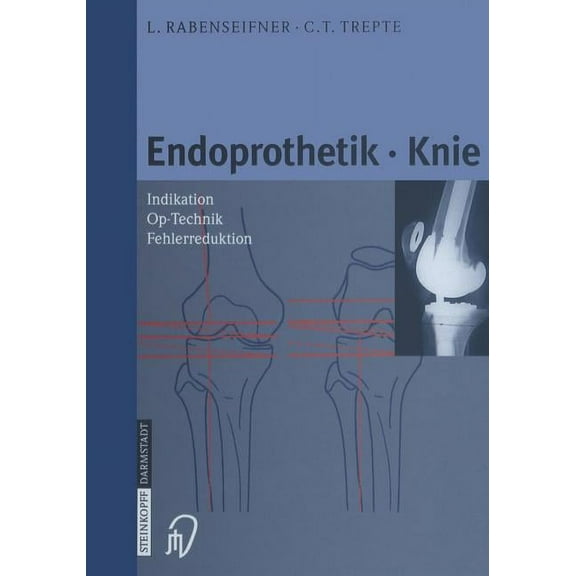 Endoprothetik Knie, (Paperback)