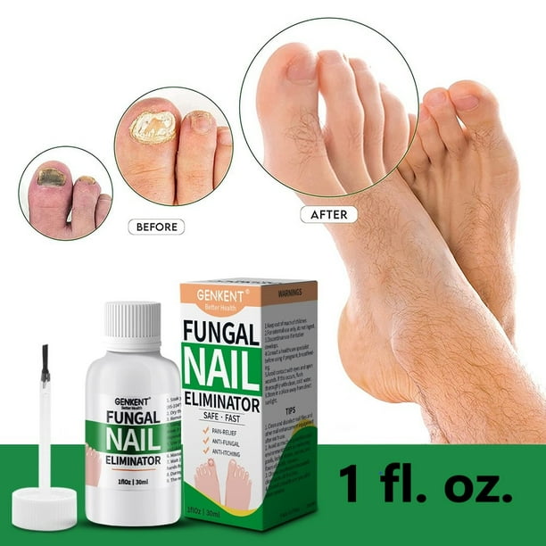 Genkent Fungi Nail AntiFungal Oil, Nail Fungus Treatment for Toenail
