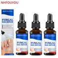 thumbnail image 1 of Aceite para tratamiento de uñas por hongos, esencia para reparación de pies, eliminación de hongos en las uñas de los pies, Gel, crema antiinfección, eliminación de uñas por hongos, 10ML Dengxun unisex, 1 of 2