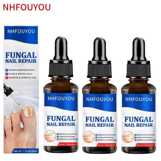 Aceite para tratamiento de uñas por hongos, esencia para reparación de pies, eliminación de hongos en las uñas de los pies, Gel, crema antiinfección, eliminación de uñas por hongos, 10ML Dengxun unisex
