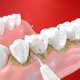 thumbnail image 5 of Electric Teeth Cleaning Machine Efficient Orals IrrigatorCare Tool for Removing, 5 of 5