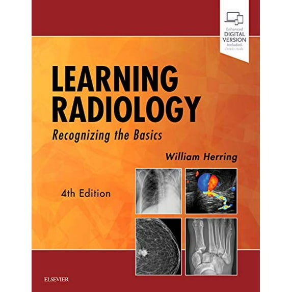 Pre-Owned Learning Radiology: Recognizing the Basics (Paperback) 0323567290 9780323567299