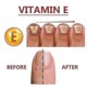 thumbnail image 3 of Nail Treatment Solution For Crooked Nails, Soft Nails, Thickened Nails, Unwell Nails And Gra, 3 of 4