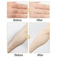 thumbnail image 4 of 20ML Natural Permanent Hair Growth Inhibitor Hair Removal Suppression Spray Body Care, 4 of 10