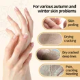 thumbnail image 2 of Crema para manos Reparadora de manos secas y agrietadas Loción con urea y vitamina E Anti-sequedad de los pies Eliminación de grietas y arrugas Blanqueadora Cuidado hidratante, 2 of 6