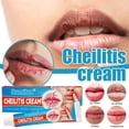 thumbnail image 2 of Queilitis Crema Antibacterial Labios Agrietados Ungüento, 2 of 10