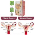 thumbnail image 3 of 20Packs/Box Warm Uterus Tea Uterus Detox Tea Fibroid Tea for Female_c*, 3 of 5