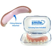 Instant Smile 2-Pack of Natural Shade Makeover Comfort Flex Fit Top Upper Veneer