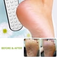 thumbnail image 4 of Lima para pies, removedor de vello de pies de doble cara, exfoliante de tratamiento para pies de acero inoxidable, 4 of 6