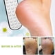 thumbnail image 4 of Lima para pies, removedor de vello de pies de doble cara, exfoliante para tratamiento de pies de acero inoxidable, 4 of 6