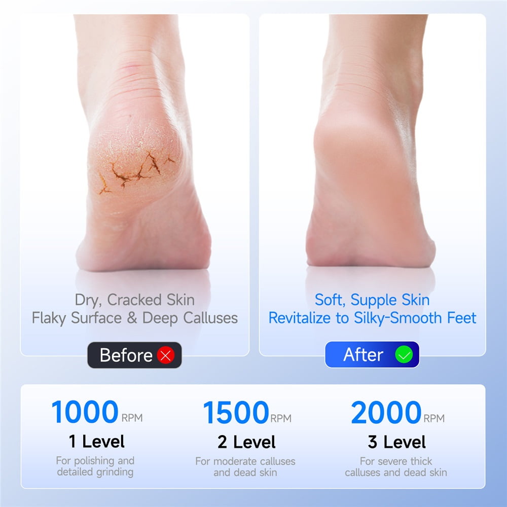Foot Callus Remover,Electric Foot File Callus Remover for Feet,Upgraded Professional Foot Scrubber Pedicure Tools for Dead Skin,Adjustable Speed Feet File Grinder for Skin and Calluses