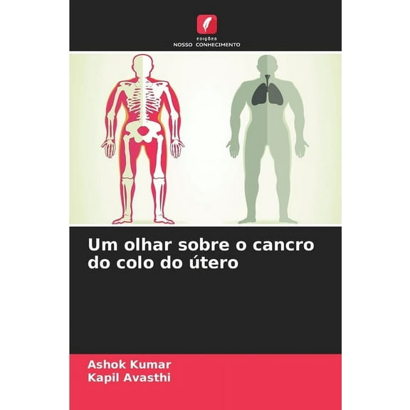 Um olhar sobre o cancro do colo do útero, (Paperback)