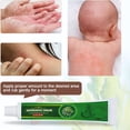 thumbnail image 2 of Crema de eczema de 20g para Dermatitis, prurito, pomada para Psoriasis, crema antipicazón, crema Herbal china Natural, 2 of 7