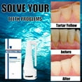 thumbnail image 4 of 30ML Calculus Dissolving Dental Spray Natural Plant Plaque Remover for Teeth Mouthwash, 4 of 7