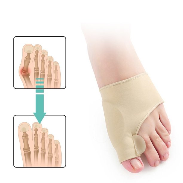 Willstar 1 Pair Elastic Bunion Sleeve Protector Prevent Hallux Valgus ...