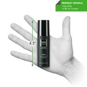 Tiege Hanley Mens ACNE Cream - 0.85 oz | Salicylic Acid 1.6% | Reduce Acne and Breakouts