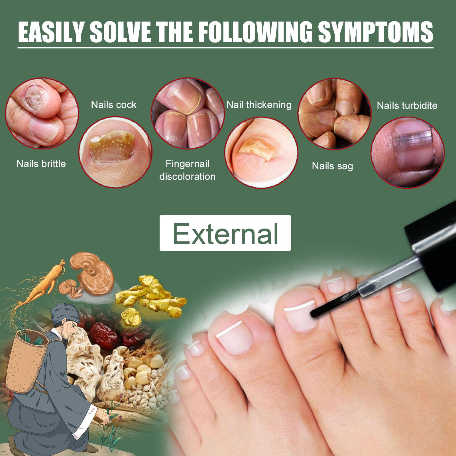 Alvantor Nail Fungus Treatment Solution for Thickened and Softened Damaged Nails, 0.5fl oz