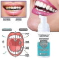 thumbnail image 2 of 3 Bottles 100ml Teethaid Calculus Removal Teeth Mouth Eliminating Bad Preventing And Caries Tooth Re 100ML 1Pcs, 2 of 5