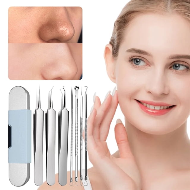 Fiudx Remove Puntos Negros, Juego Pinzas de Acero Inoxidable, Kit de Extracción y Mango Antideslizante, Estuche de Viaje Incluido, Artículos Esenciales para Cuidado Facial, Uso Profesional, Diseño Du