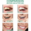 thumbnail image 4 of Pipiup Toothpaste, Niacinamide Whitening Toothpaste, Triple Action Formula for Whiter Teeth & Fresh Breath, Enamel Safe Whitening & Stain Removal (1), 4 of 8