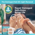 thumbnail image 5 of Toenail Fungus Treatment Extra Strength, Nail Repair For Damaged Nails, 32 Pcs Fungal Nail Patches, Nail Fungus Treatments Patches Not Easy to Fall Off, 5 of 9