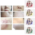 thumbnail image 4 of braveheart LED Face Mask Light Dark Wireless Spot Tightening for SPA Home Style A 1Set, 4 of 6