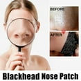 thumbnail image 4 of Deep Cleansing Nose Pore Strips 10-Pack Blackhead Removal Non-Woven Rayon Facial Treatment, 4 of 9