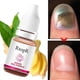 thumbnail image 4 of RtopR Ginger nail polish Nail Treatment Fungal Nail Repair Rough nail repair Promote nail growth Anti fungal nail infection, 4 of 5