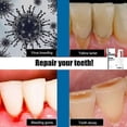 thumbnail image 5 of Aerosol disolvente dental removedor de sarro 2 piezas yuxing, 5 of 5