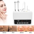 thumbnail image 4 of Máquina de eliminación de manchas, máquina de cuidado facial de eliminación de manchas de pecas por ultrasonidos Máquina de rejuvenecimiento de la piel diseñada para el futuro, 4 of 14