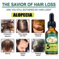 thumbnail image 5 of Ginger hair care essential oil nourishes, softens and repairs frizzy and damaged, 5 of 5