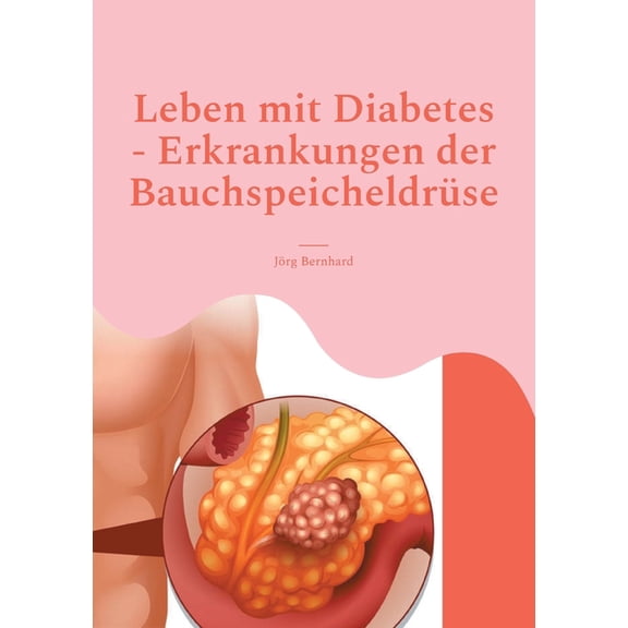 Leben mit Diabetes - Erkrankungen der Bauchspeicheldrüse: Umgang mit Diabetes, Leben ohne Bauchspeichel möglich, Funktio, (Paperback)