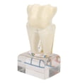 thumbnail image 2 of Modelo de nervio Dental profesional, modelo de dientes de demostración para estudio de enseñanza Dental, 2 of 5