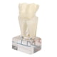 thumbnail image 3 of Modelo de nervio dental BuyWeek didáctico profesional, 3 of 14