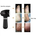 thumbnail image 3 of Removedor de callos eléctrico para pies, amoladora eléctrica portátil para pies, lima para pies, pedicura, elimina la piel seca y agrietada, 3 rodillos negros, 3 of 5