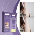 thumbnail image 1 of High Coverage Body Concealer & Corrector Cream - Long-Lasting Repair Formula for Blemishes & Discoloration, Versatile Full-Body Application, Moisturizing & Nourishing, Enhances Skin Tone, 1 of 9